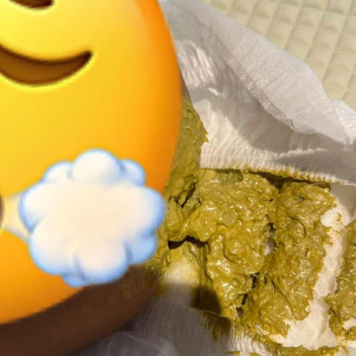 najis bayi berubah warna