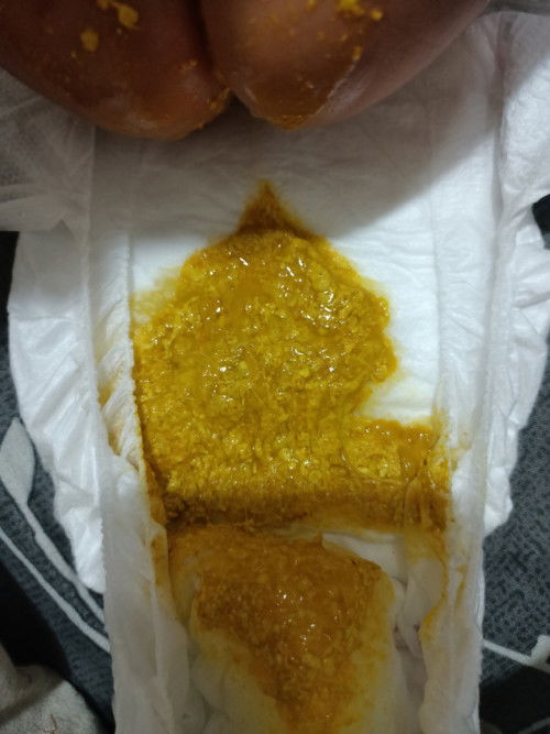 Pup bayi 1 bln normal gak ya