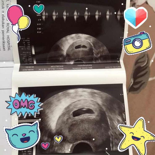 Pertama kali usg transv