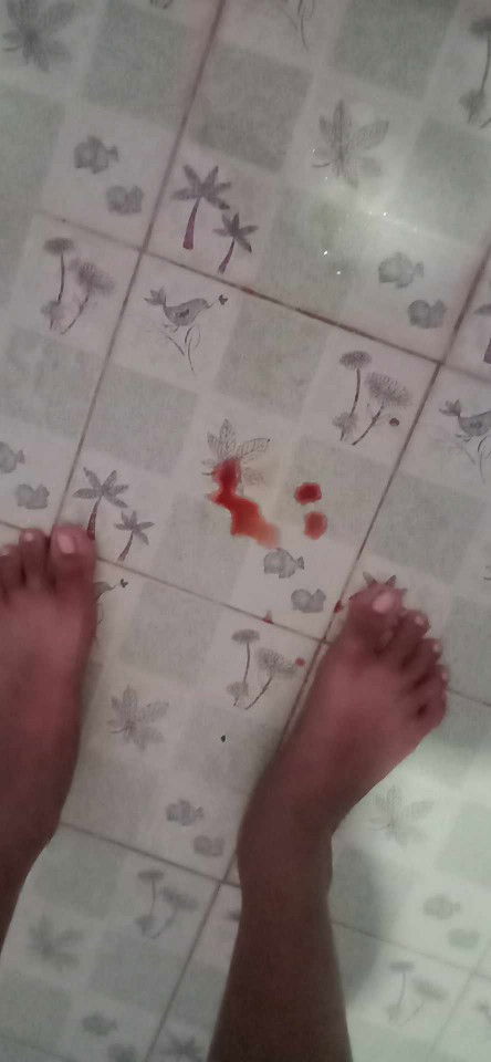 มีเลือดออกจากช่องคลอด ทุกวันแต่ไม่เยอะ มันคือเลือดอะไรค่ะ