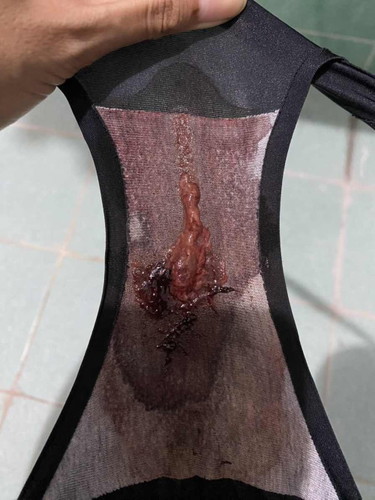 คลอดมาจะ1เดือนแบบนี้คืออะไรคะ ปกติไหมคะ