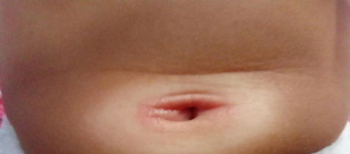 Ada yang tau uni kenpa sama obat nya apa ya bund..umur bayi 5 bulan.apa ada alergi dari asi