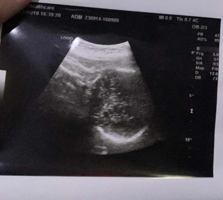 36+3w ดูยังไงคะทุกคน😢