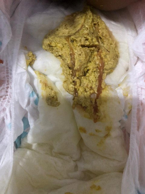 bab anak berlendir