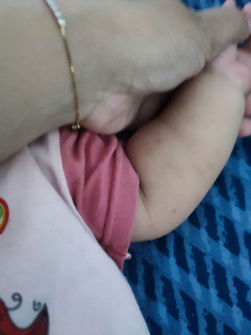 Bintik merah d area tertentu