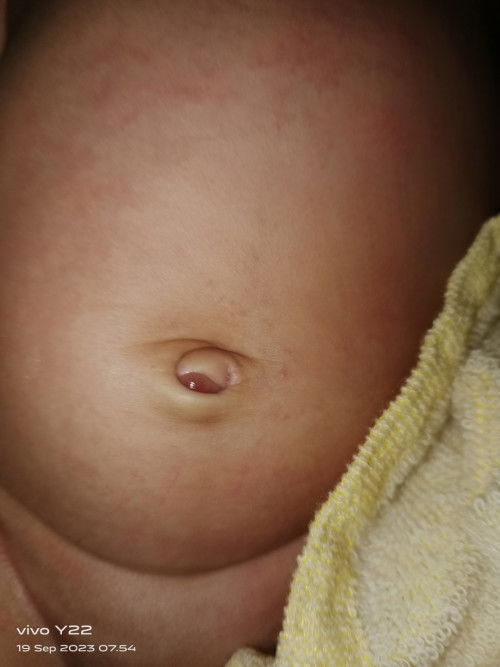 Pusar bayi suka berair