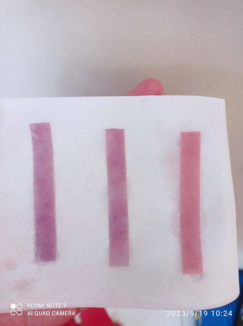 Bedanya air sperma sama ketuban