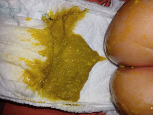 Bayi 4bulan pup 3x sehari apakah normal?