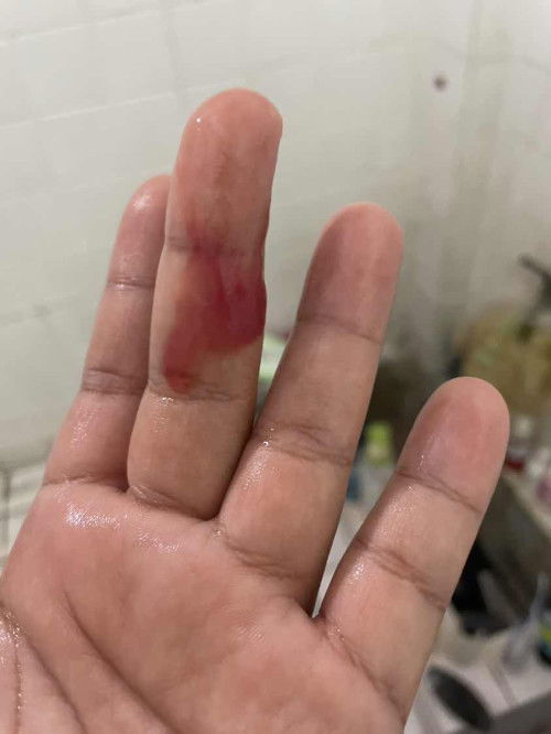 ขอคำแนะนำหน่อยค่ะ