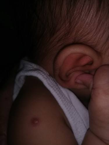 Mga momshies may ganto den po ba bibi nyo? Dito tinurukan si baby nung pagka panganak nya