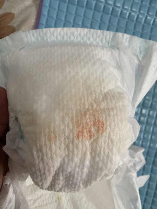 Bercak orange pada bayi di diapers