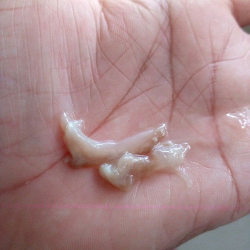 38+5ค่ะ เมื่ออาทิตย์ก่อนมีมูกเลือด
แต่พอมาวันนี้ มีมูกใสใสออกมาเราฉี่มันเลยออกมาแบบนี้ แม่แม่มีอะไรแ