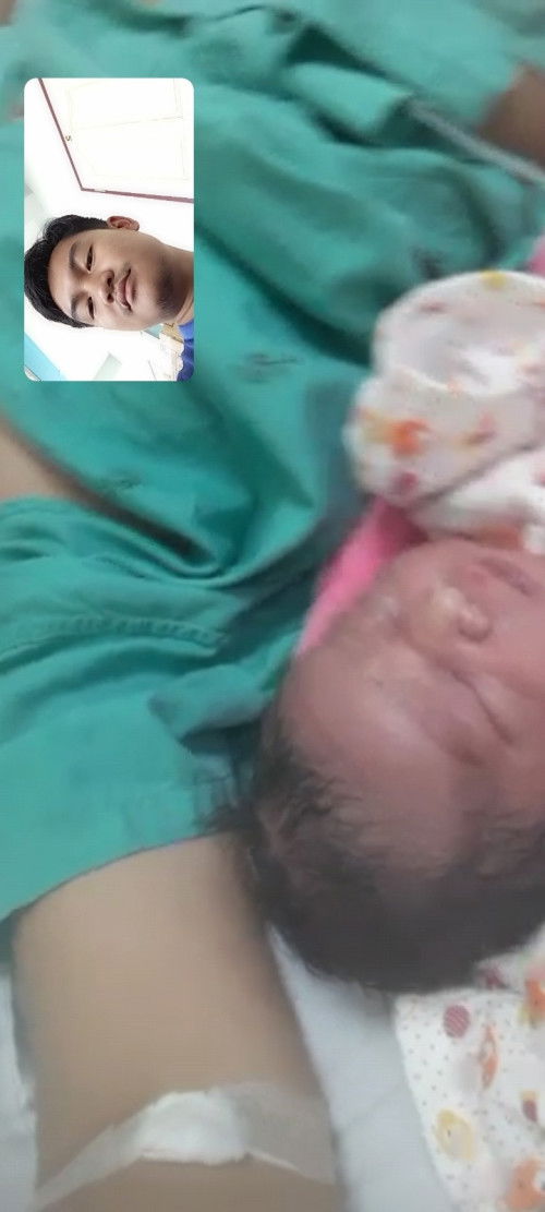 ลูกชายพึ่งคลอดวันนี้คับ แล้วหัวน้องยาวหมอบอกว่าเดี๋ยวก็หายจะหายจริงไหมคับหือต้องทำยังไง