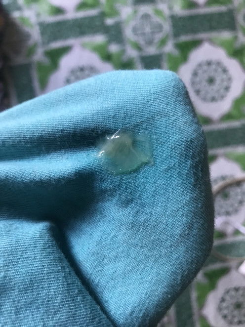 มีมูกแบบนี้ใกล้คลอดหรือยังค่ะ
ต้องไปโรงบาลเลยมั้ยค่ะ