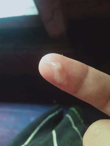 Mau nanya Bun ini tanda mau melahirkan atau apa dkadang2 perut keras setiap sejam sekali