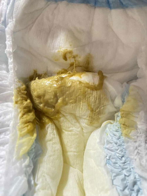 ขออนุญาตนะคะ ถ่ายเป็นวุ้นแบบนี้ปกติไหมคะ