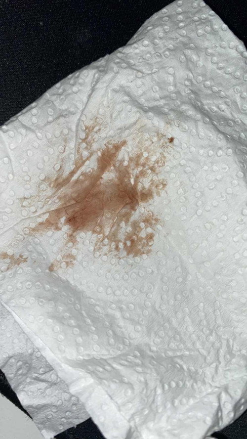 normal ka period macam ni ?