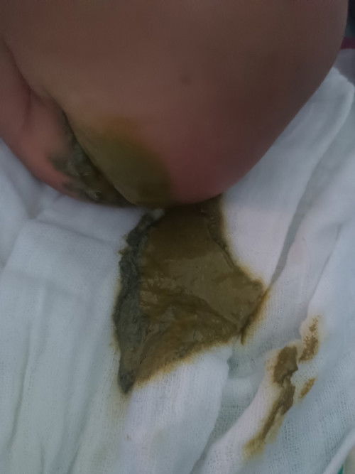 Baby poop dark green