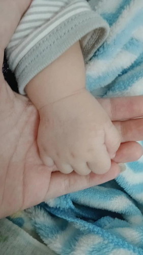 3 hari masih demam setelah imunisasi
