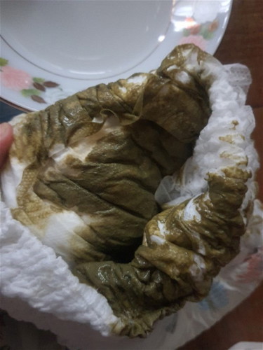 ถ่ายสีเขียวออกดำ