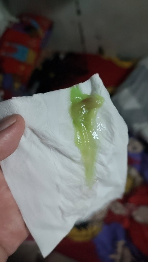Discharge o mucus