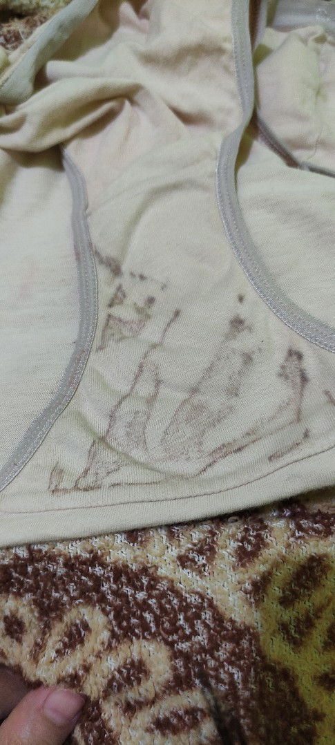 Flek habis naik motor