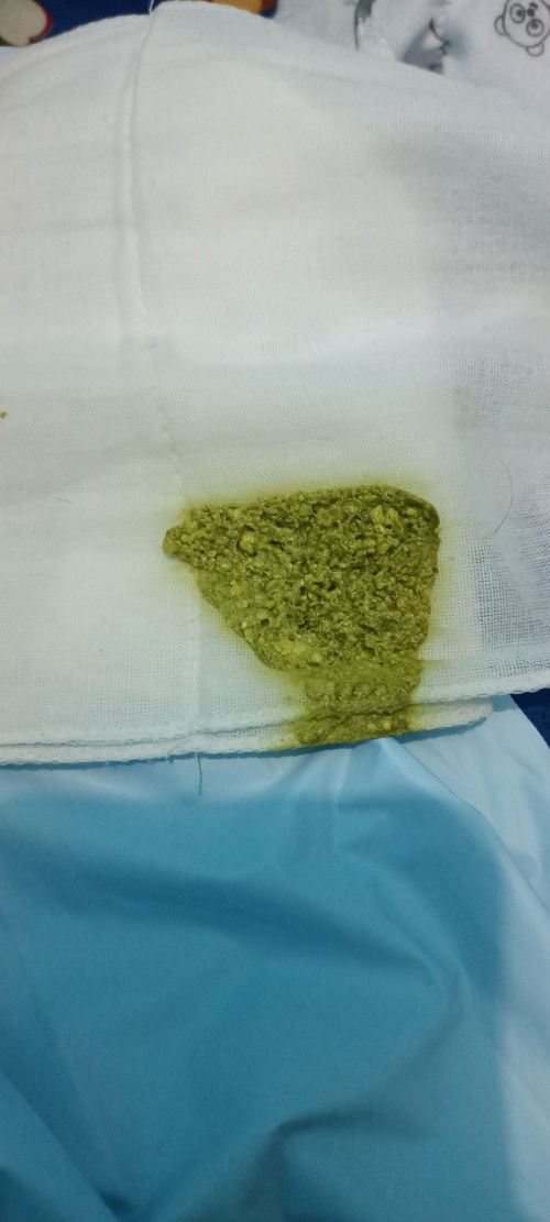 Permisi bunda mau tanya , pup seperti ini normal tidak ya ? Tapi ada ampasnya kok