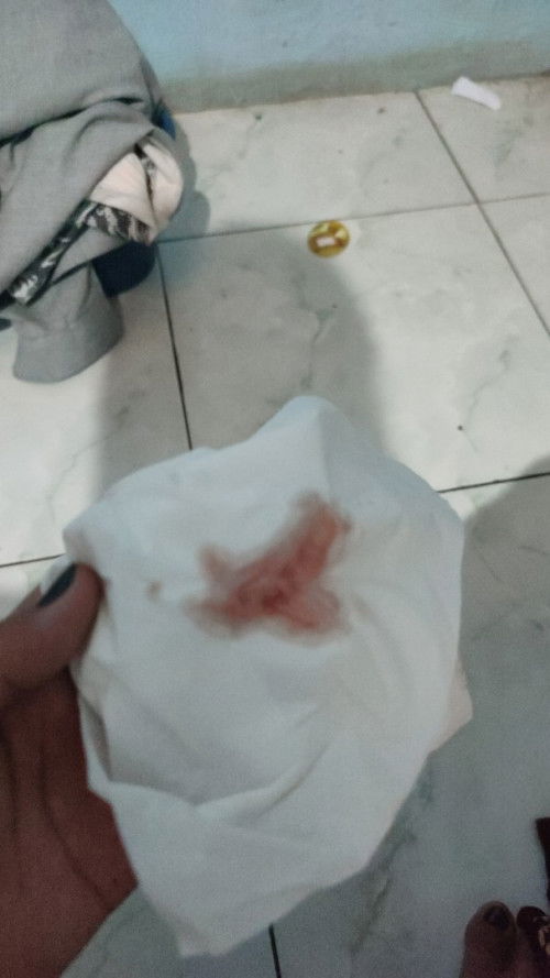 Tanda pembukaan atau hanya kecapekan?