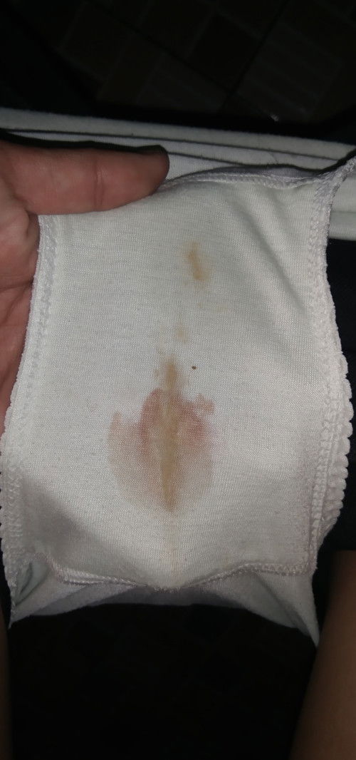 Bun mau tanya dong kalau misal muncul sperti darah tp warna agak pink di usia kandungan 8 minggu