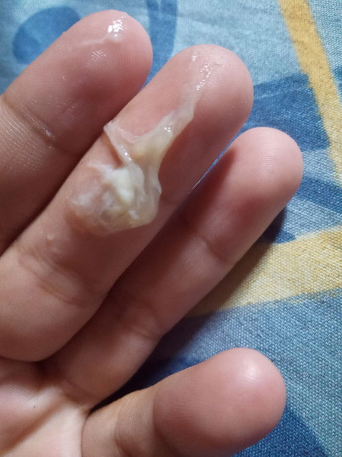 Bun kenapa yh setiap perut keras selalu keluar ke gini . apakah tanda mau bersalin.atau cuma keputih