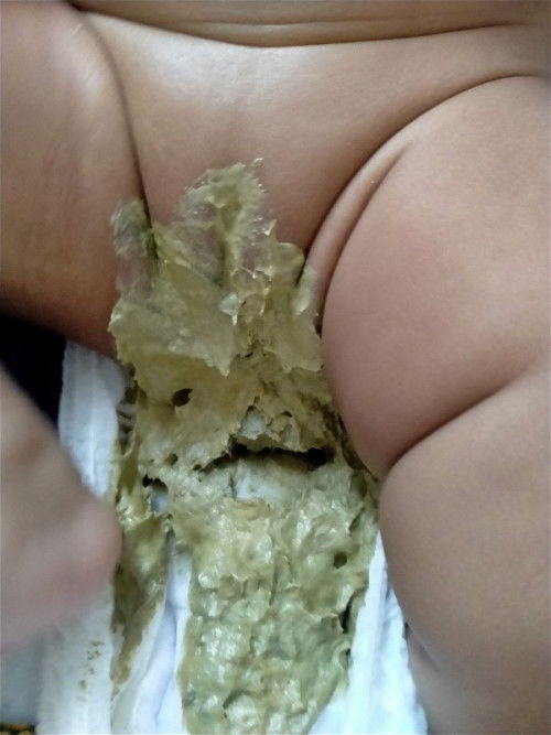 Tahi bayi 2 bulan susu formula