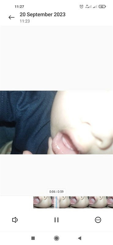 Tumbuh gigi baby 6 bulan