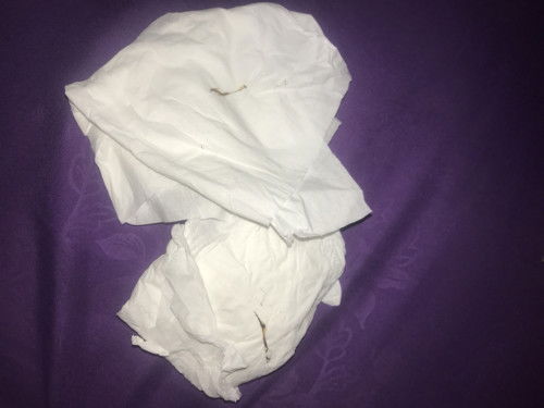 Flek atau bukan ya bun ?