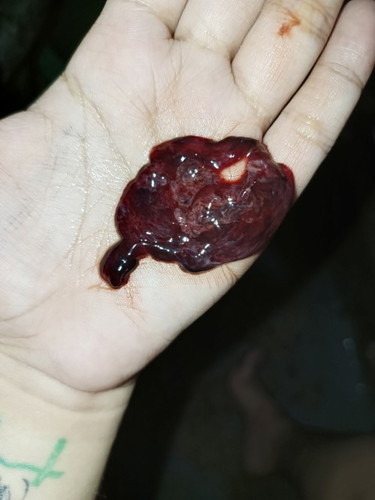 Nakunan nga ba ako?