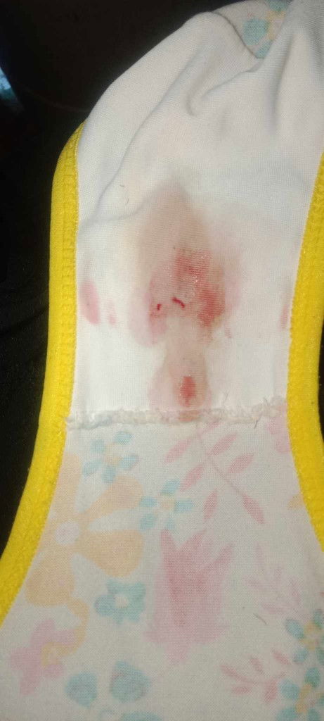 Ano po ibig sabihin kapag nagka spotting ako?