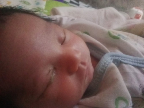 Bun mau nnya obat sakit mata untuk bayi umur 3 hari apa ya bun🙏