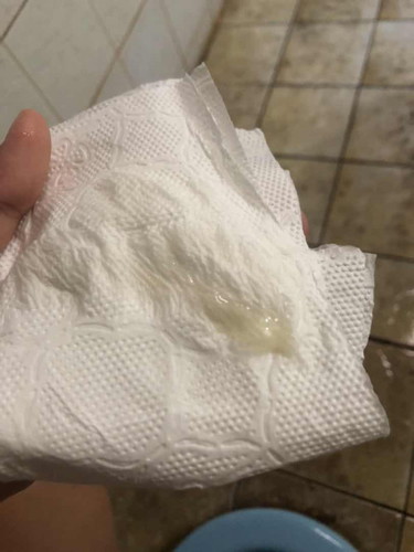 มีมูกแบบนี้ใกล้คลอดหรือยังคะ ท้องแรกไม่มีประสบการณ์เลย