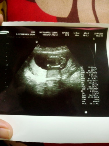 สอบถามแม่ๆเรื่องเพศลูก