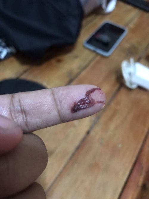 Mucus plug po ba ito?