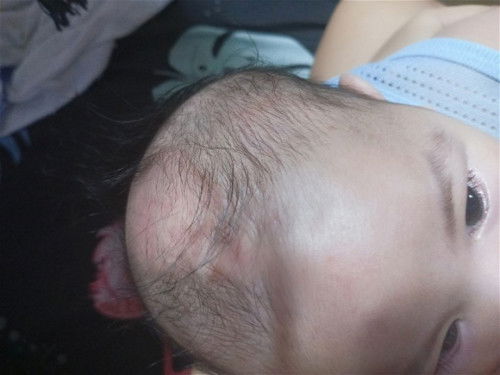 Mommies pahelp pasagot plss bakit kaya nagkaganito ung ulo ng baby ko, nag start sa pamumula ++