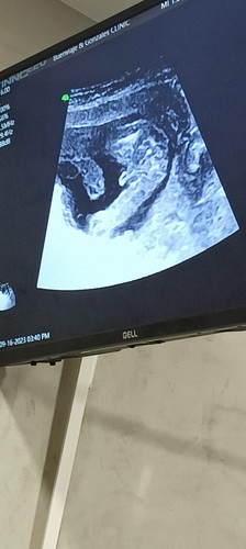 Gender ni baby?