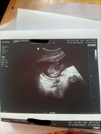 Boy or Girl