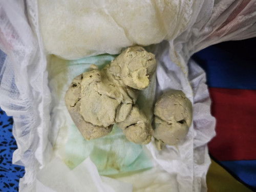 Taik warna ini normal ke?