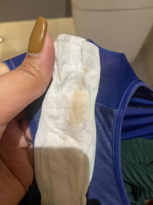 Ini flek apa keputihan ya bun