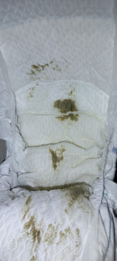 Mengenai warna pup bayi