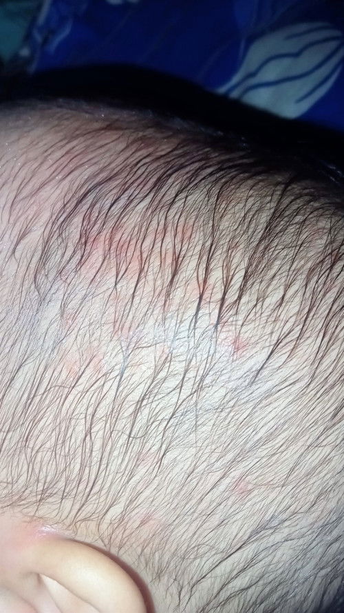 Kepala anak beruntusan