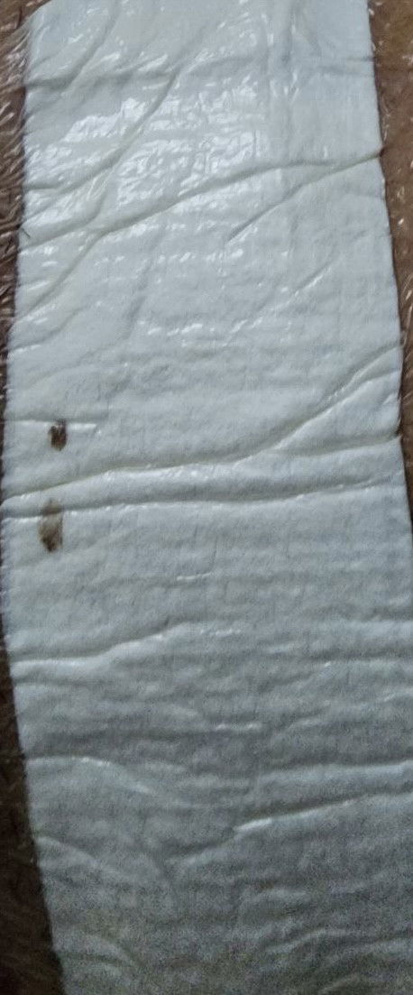 C-section wound slight bleeding