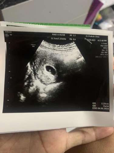 7w+3 ขนาดเท่านี้ ยังไม่ได้ยินเสียงหัวใจ ปกติมั้ยคะ