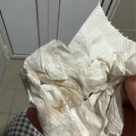 อันนี้ใช่มูกเลือดไหมคะ ต้องไปโรงพยาบาลไหม