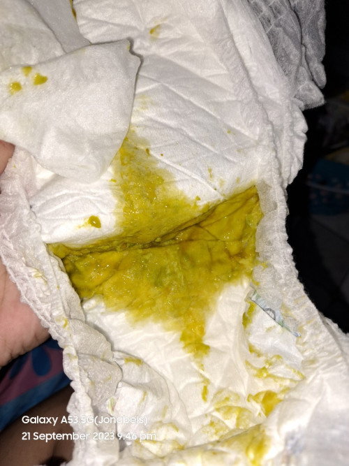 Ask lang mga mii, normal po ba yung dumi ni lo?? Nag poop kasi sya ganyan after nia dumede.